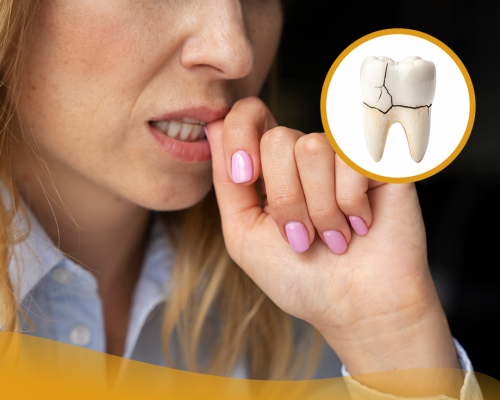 Les pires habitudes qui endommagent vos dents 